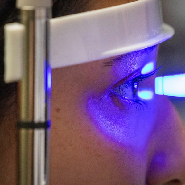 Primer plano de un ojo examinándose con luz azul en una lámpara de hendidura durante un procedimiento clínico.