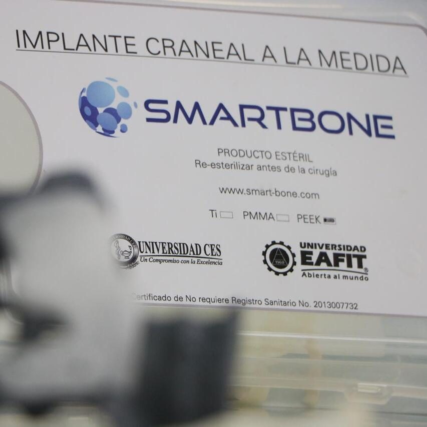 Etiqueta de un implante craneal personalizado con la marca SmartBone y los logotipos de dos universidades, acompañada de un componente médico en primer plano desenfocado.
