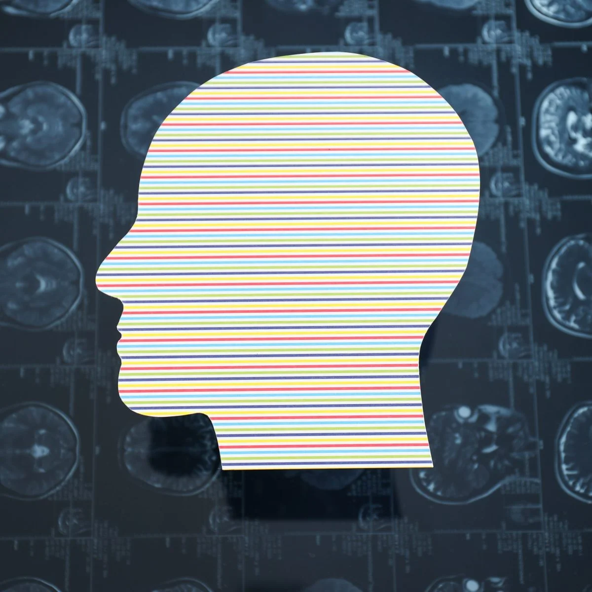 Silueta de una cabeza humana con líneas de colores en su interior, sobre un fondo de imágenes médicas del cerebro tipo resonancia.