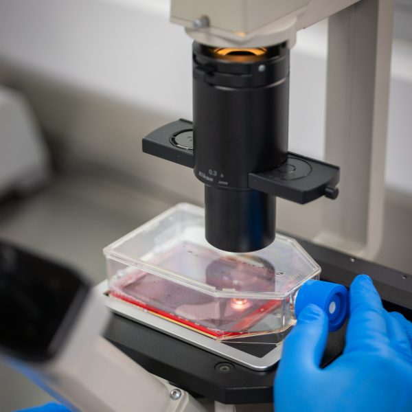 Microscopio enfocado en una caja transparente con líquido rojizo, sostenida por una mano con guantes azules en un entorno de laboratorio.
