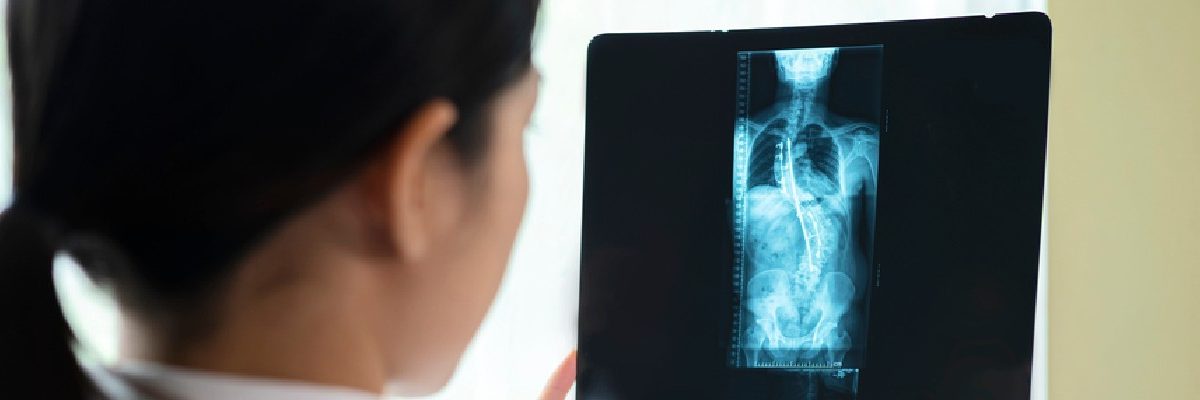 Triage radiológico, un servicio que optimiza el servicio de radiología
